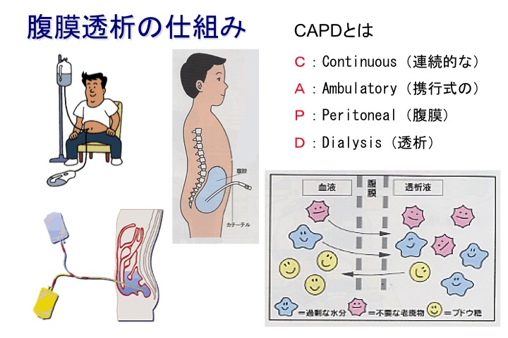 人工腎臓の実際 秋沢 忠男