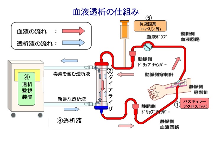 これから透析導入される方へ 東京 透析 池袋久野クリニック公式ページ 豊島区 池袋駅から近く 内科 腎臓病 人工透析